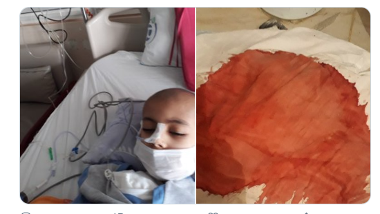 Suavi’den Ahmet Burhan çağrısı: Bu kan boya değil