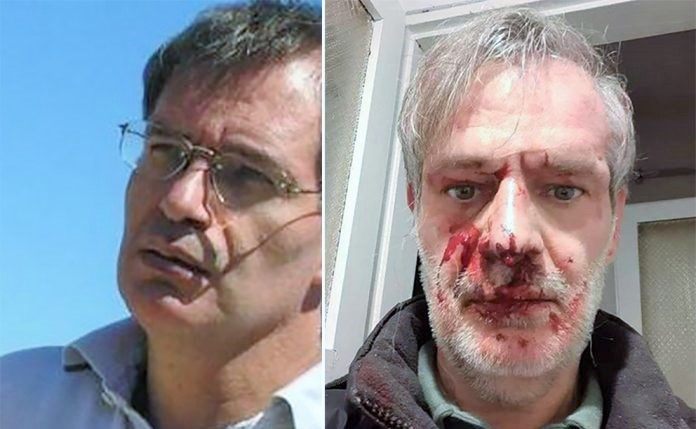 “Devlet Bahçeli’ye Corona bağışlayacak bir hayırsever yok mu yahu?” diyen yazara saldırı