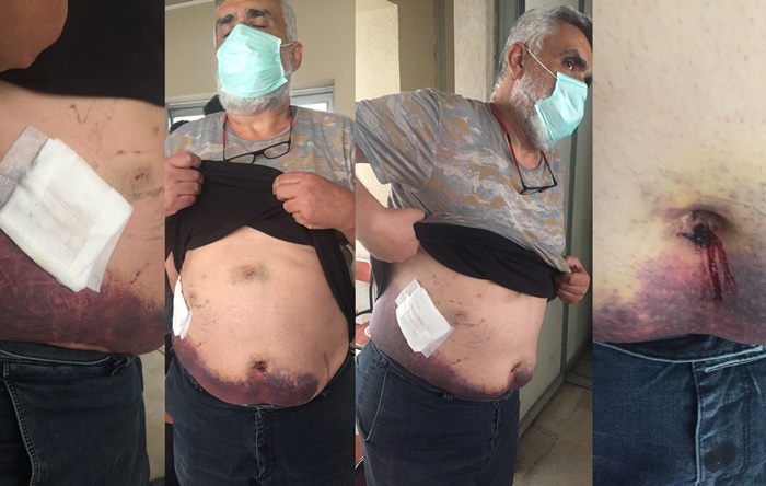 Adana’da açık kanaması olan hayırsever, tutuklanarak cezaevine gönderildi