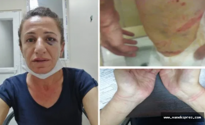 HDP: Diyarbakır Valiliği işkenceyi gizliyor, işkencecileri koruyor