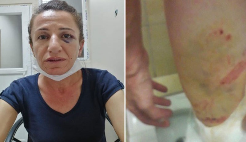 Müvekkilinin gözaltında işkence gördüğünü açıklayan avukat ifadeye çağrıldı