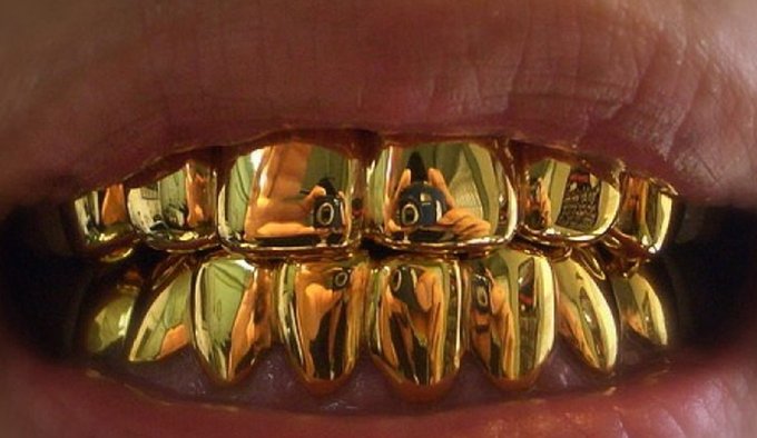 Ameliyat öncesi alınan altın dişleri yanlış kişiye verdiler