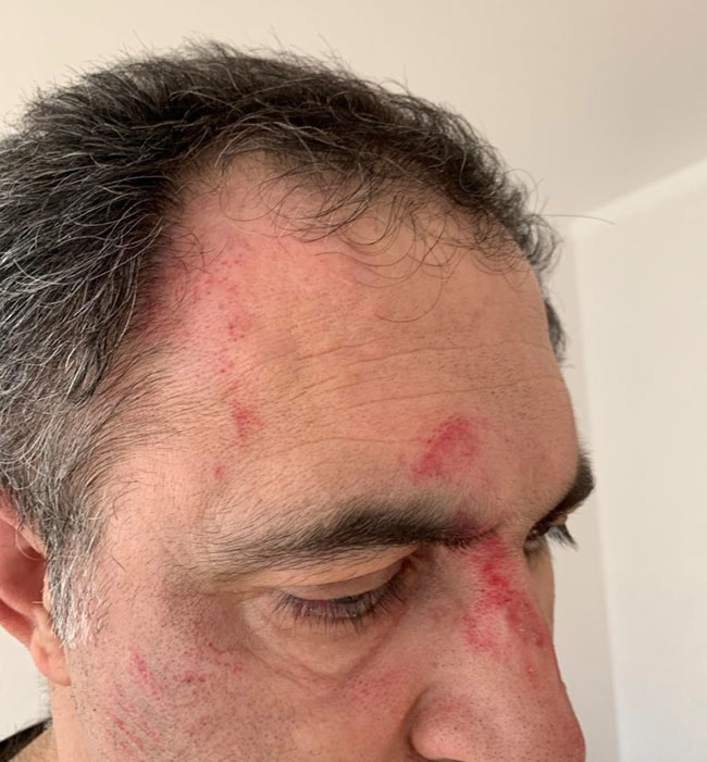 Gazeteci Abdullah Bozkurt’a İsveç’te saldırı