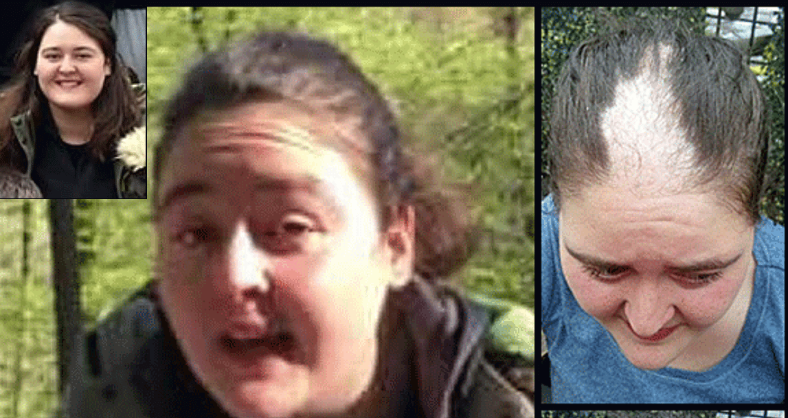 Polisin saçlarını kökünden kopararak gözaltına aldığı Bergün Varan tahliye edildi