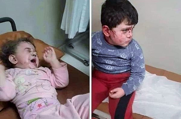 Ermenistan, Gence’yi vurdu: 9 kişi öldü. 34 kişi de yaralandı