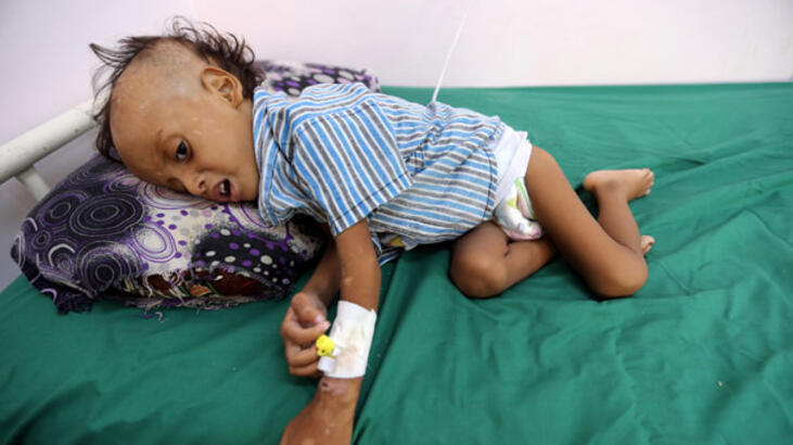 UNICEF Başkanı: Yemen’de 12 milyondan fazla çocuk insani yardıma muhtaç