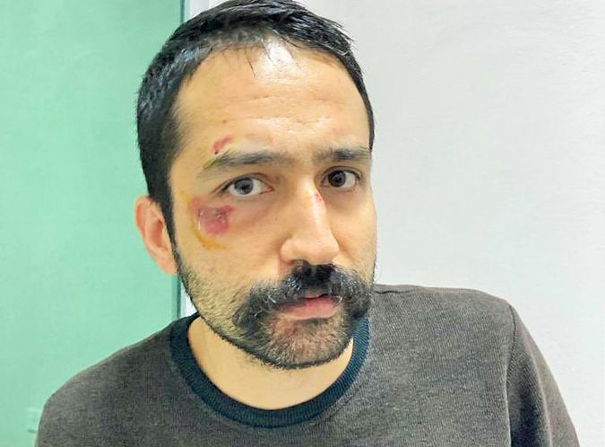 Av.Ünsal’ın babası oğluna Edirne’de yapılan işkenceye isyan etti: Yaşamak için nereye gidelim