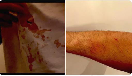 ‘Birgün öldürülürsem bilin ki, Tayyipçiler yaptı’ diyen boksör Ünsal Arık’a, bıçaklı saldırı