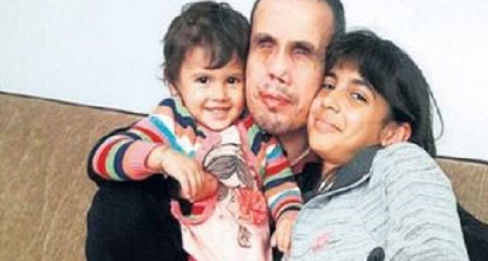 AKP yargısının hukuk cinneti: Bomba imha ederken iki gözünü ve elini kaybeden gazi polisi ‘terörist’ ilan etti ve hapse attı