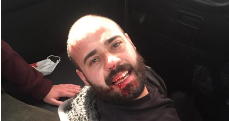 Ankara ve İstanbul’da polis şiddeti: Öğrenciler darp edilip ters kelepçe takıldı