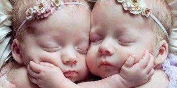 İngiltere’de yapılan bir araştırma: Dünyada ikiz bebek doğumlarında patlama