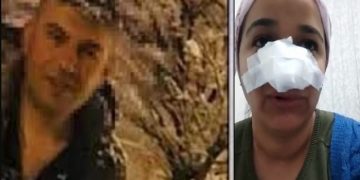 Bingöl’de uzman çavuş, bir kadını darp edip burnunu kırdı