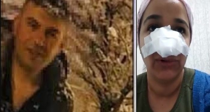 Bingöl’de uzman çavuş, bir kadını darp edip burnunu kırdı