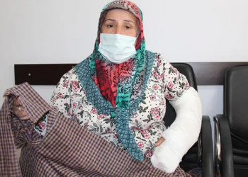 Diyarbakır’da polis şiddeti: 55 yaşındaki kadının dişlerini ve kolunu kırdı