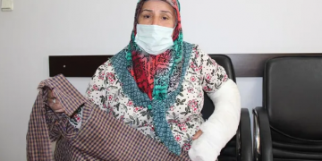 Diyarbakır’da polis şiddeti: 55 yaşındaki kadının dişlerini ve kolunu kırdı