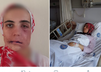 Kanser hastası Ayşe Özdoğan’ın feryadı: Çok çaresizim, sesime ses olun!