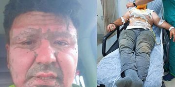 Ağır yaralanan KHK’lı askerin eşi feryad etti: Yıldızlarını söktüğünüz üsteğmenin haline bakın, ne suçu vardı?