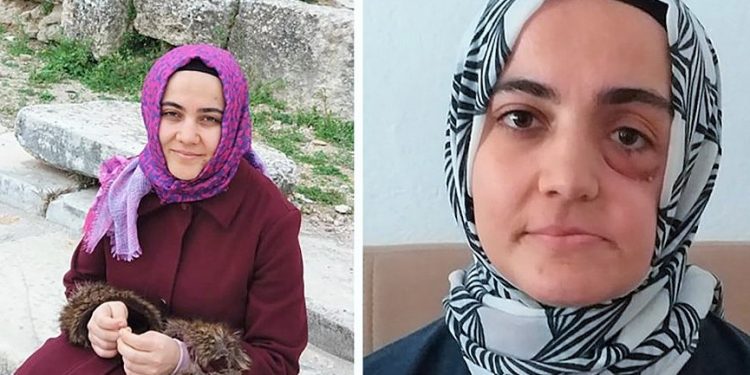 Hak İnisiyatifi’nden Erdoğan’a kanser hastası Ayşe Özdoğan çağrısı: Af yetkinizi kullanın