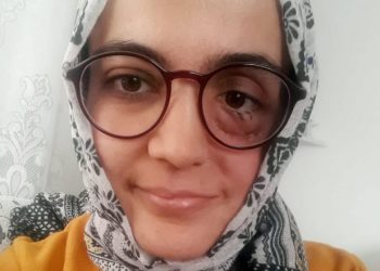 Cezası onandı, ağır hasta kadın tutuklanacak!