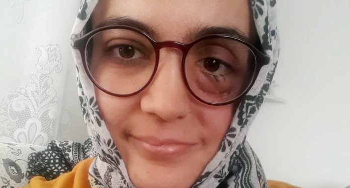 Cezası onandı, ağır hasta kadın tutuklanacak!