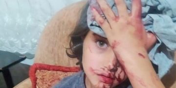 Göçmenlere saldıranlara polis yol gösterdi: Sessiz olun, parça parça hareket edin