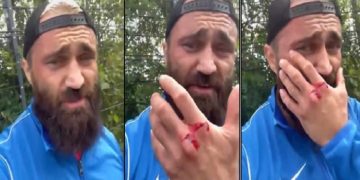 Boksör Ünsal Arık, Almanya’da Erdoğan taraftarlarının ikinci kez saldırısına uğradı