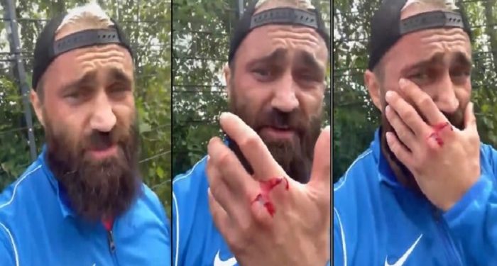 Boksör Ünsal Arık, Almanya’da Erdoğan taraftarlarının ikinci kez saldırısına uğradı