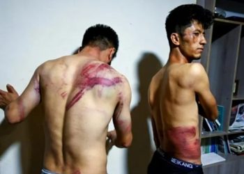 Afgan gazeteciler kırbaçlanarak gördükleri işkenceyi dünyaya duyurdu