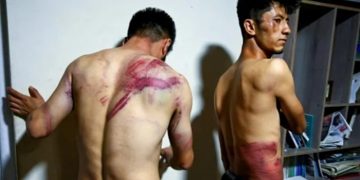 Afgan gazeteciler kırbaçlanarak gördükleri işkenceyi dünyaya duyurdu