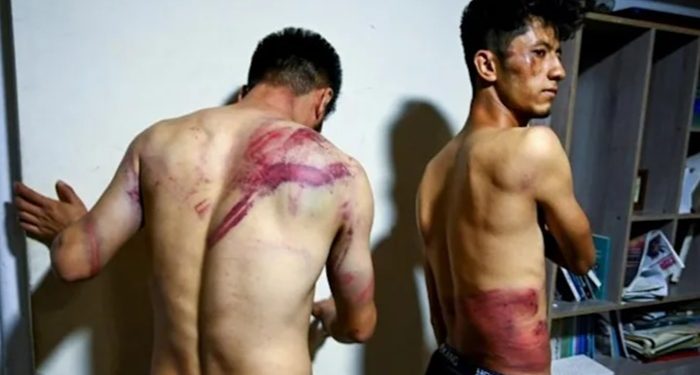 Afgan gazeteciler kırbaçlanarak gördükleri işkenceyi dünyaya duyurdu