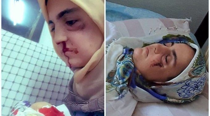 Cezaevine konulan kanser hastası Ayşe Özdoğan’ın ablası: Polisler evden ite kaka çıkardılar