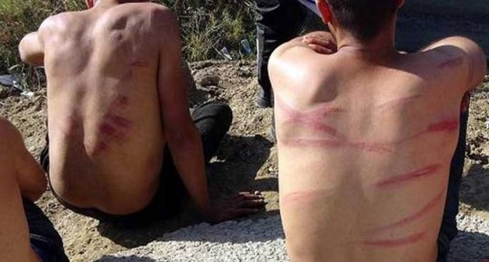 Yunanistan göçmenleri dövüp yarı çıplak Türkiye’ye geri itti