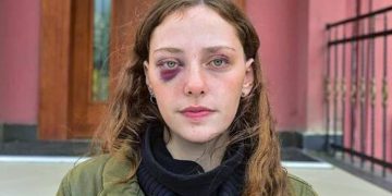 Gözaltında darp edilen Mısra Sapan: ‘Direkt yüzüme diz attı, yerde tekme ve yumruklarla vurdular’