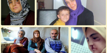 Ayşe Özdoğan’ın annesi: Dişleri yok kızımın, şırıngayla mama veriyorum