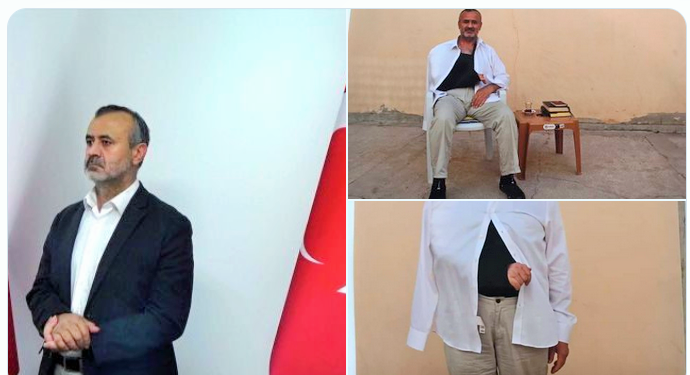 Erdoğan rejiminin fotoğrafı : MİT’in kaçırıp işkence ettiği Orhan İnandı, aylar geçmesine rağmen hala kolunu kullanamıyor