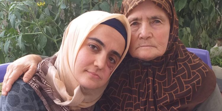 Ayşe Özdoğan’ın annesi: Dişleri yok kızımın, şırıngayla mama veriyorum