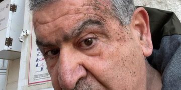 Emekli hâkim Mehmet Beyazıt Boran’a polis şiddeti iddiası