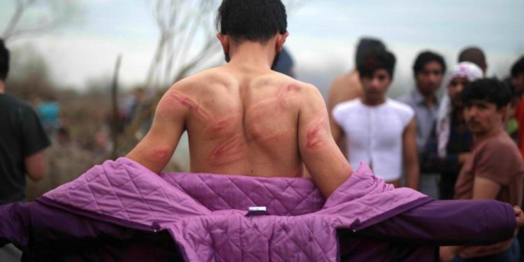 Yunanistan askerleri, AB için çalışan tercümanı dövdükten sonra Türk tarafına bıraktı