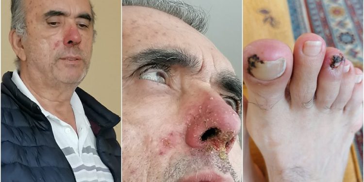 Tutuklu kanser hastası Ahmet Zeki Özcan’ın kızının feryadı: Sesime ses olun, babamı ölüme terk etmeyin