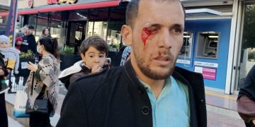 Erdoğan rejimi zulümde sınır tanımıyor: Polisin saldırması sonucu, birçok Furkan Vakfı gönüllüsü yaralandı