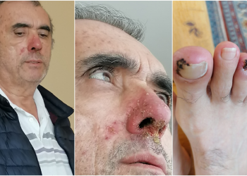 Hasta hukuku paspas edildi: 4. evre akciğer kanseri Ahmet Zeki Özkan’ı tutukladılar