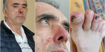 Hasta hukuku paspas edildi: 4. evre akciğer kanseri Ahmet Zeki Özkan’ı tutukladılar