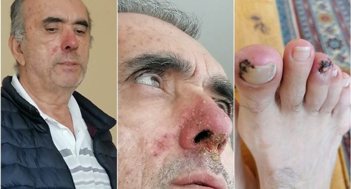 Adalet Bakanlığı nihayet duydu: Zeki Özkan’a ilaçları veriliyor, ceza tehiri işlemleri re’sen başlatıldı