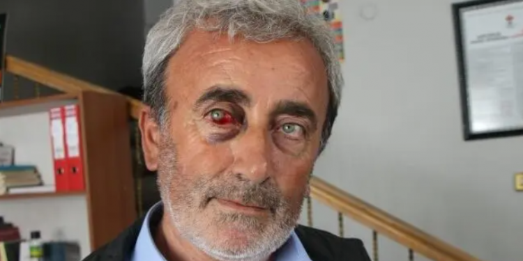 Yeneroğlu, Batman’daki işkenceyi AKP’li Bakan Soylu’ya sordu: Adı geçen kamu görevlileri uzaklaştırıldı mı?