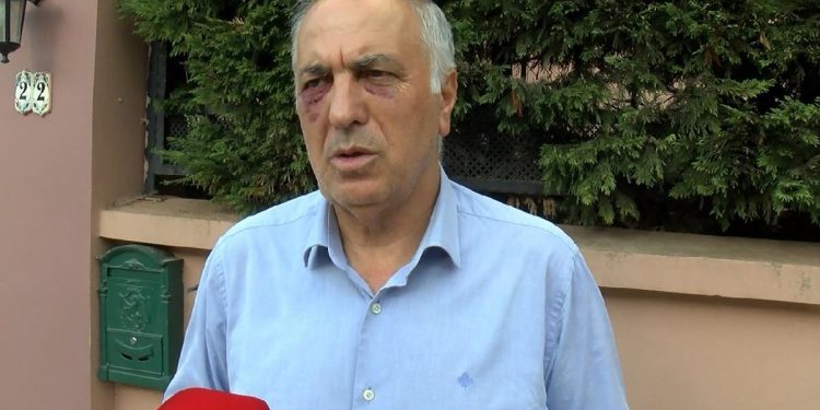 Kartal Cemevi Başkanı Sarıtaş uğradığı saldırıyı anlattı: Ankara’daki olayların devamı niteliğinde