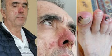 4. evre kanser hastası Ahmet Zeki Özkan tahliye edildi