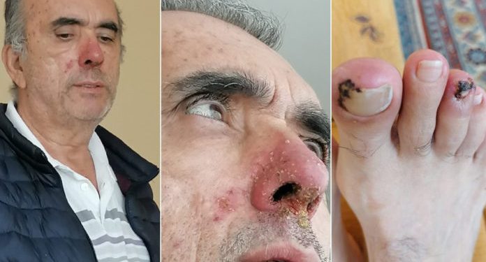 4. evre kanser hastası Ahmet Zeki Özkan tahliye edildi