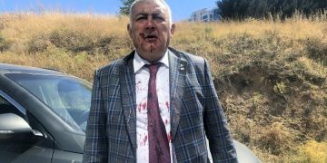 Ümit Özdağ, Zafer Partisi’nden istifa eden kurucular kurulu üyesini dövdürttü iddia edildi