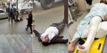 Polisin darp ettiği HDP’li Habib Eksik’in ayağı kırıldı