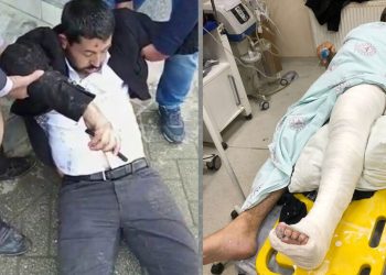 Milletvekili Habip Eksik: Polis, bilinçli olarak ayaklarımızı, bacaklarımızı kırmak için vurdular